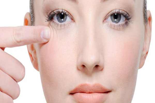 الهالات السوداء تحت العين