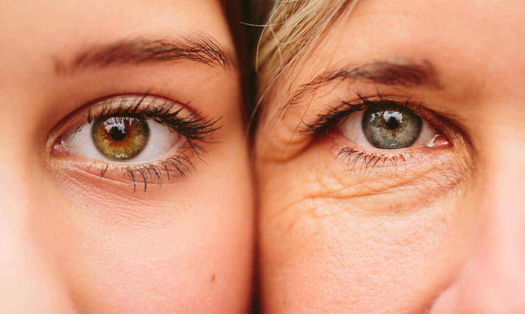 Eye Contour Rejuvenation